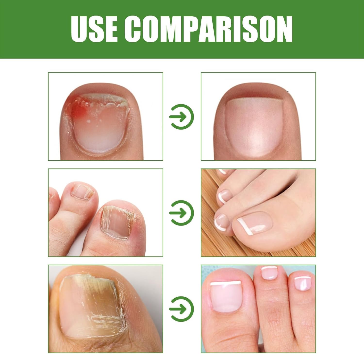 Stick Antifúngico | DRMODE