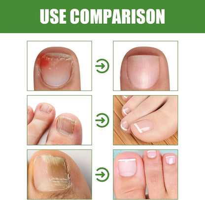 Anti-Pilz-Stift | DRMODE