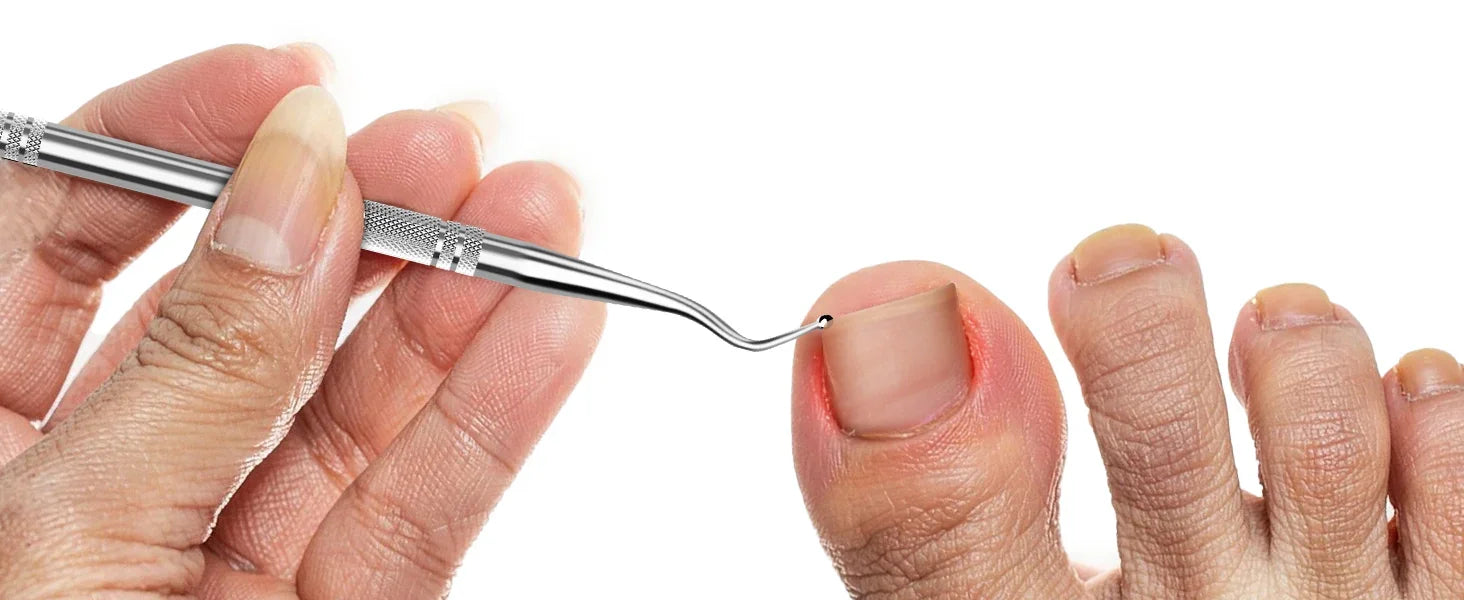 Hand using a stainless steel ingrown toenail lifter tool on a big toe