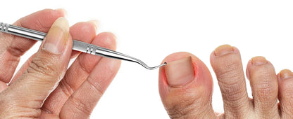 Hand using a stainless steel ingrown toenail lifter tool on a big toe
